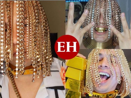 Dan Sur, influencer que asegura que se incrustó cadenas de oro en el cuero cabelludo