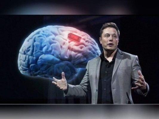 Elon Musk, durante la presentación de 'Neuralink'.