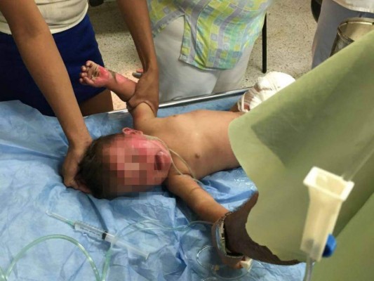 Bebé de nueve meses es rescatada de incendio en El Progreso