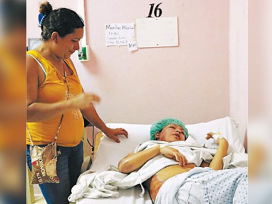 Una furiosa mujer quema a su cuñada