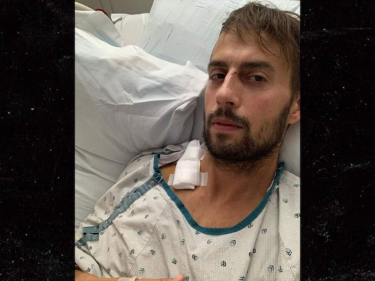 Paseador de perros de Lady Gaga relata el horror que vivió durante asalto&nbsp;&nbsp;