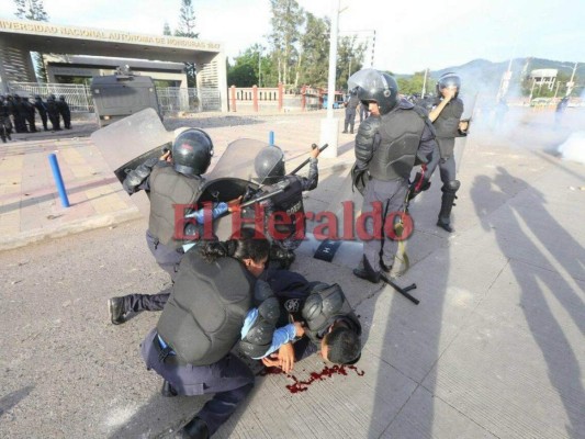 FOTOS: Violento enfrentamiento entre policías y supuestos universitarios