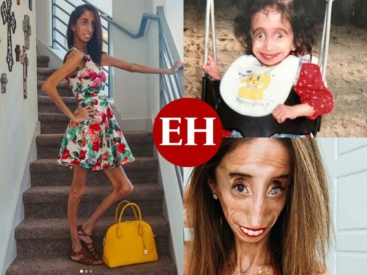 La inspiradora historia detrás de Lizzie Velásquez, la 'mujer más fea del mundo'