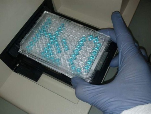 Brasil es el tercer país del mundo en autorizar el uso de la vacuna contra el dengue&nbsp;&nbsp;