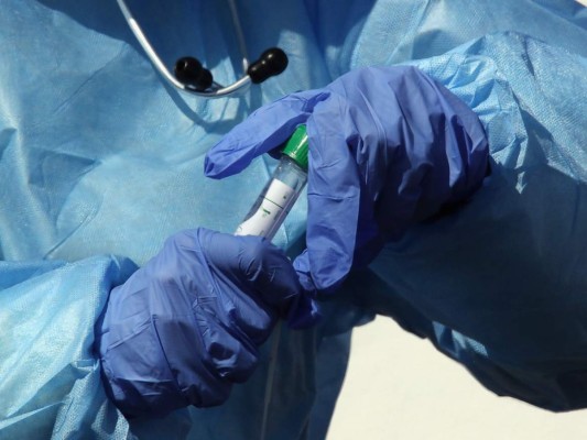 Autorizan prueba rápida que detecta el coronavirus en 45 minutos