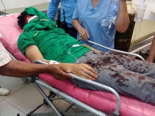 Wilson Berrios antes de ingresar al hospital: 'Papá, no lo vi venir, me explotó en la cara”