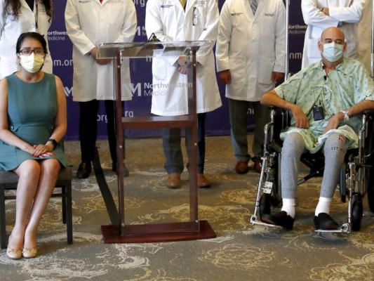 Mujer no reconocía su cuerpo tras trasplante por covid-19&nbsp;