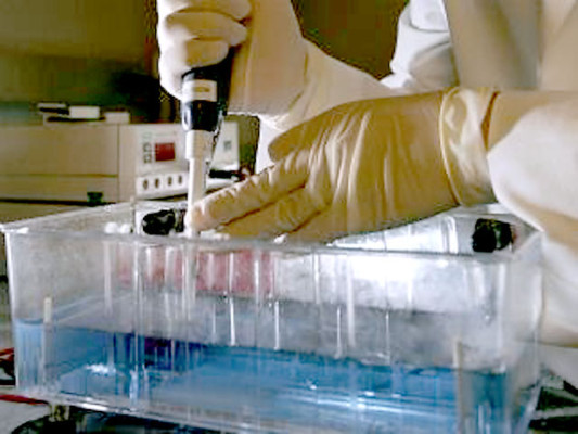 Nuevo tratamiento contra cáncer avanzado de la próstata