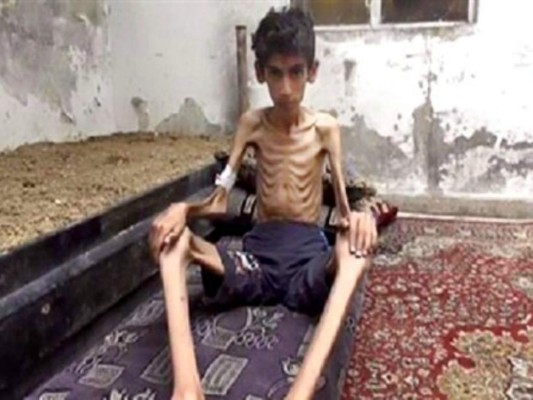 Madaya la ciudad del hambre