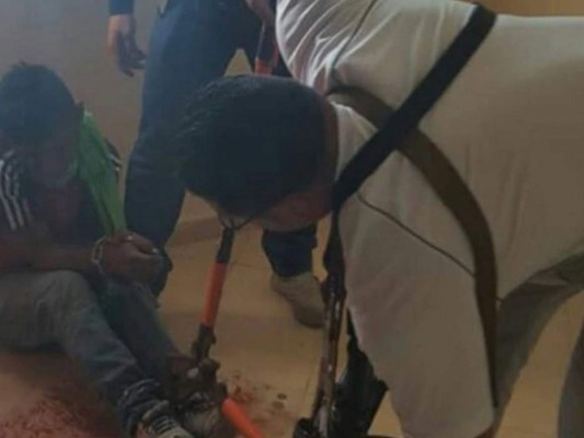 Mujer secuestró, encadenó y apuñaló a su pareja porque la dejó