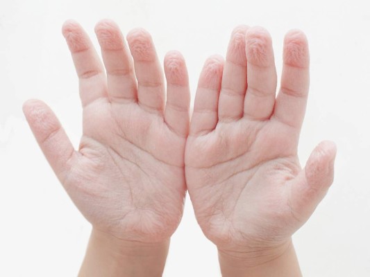 ¿Por qué se nos arrugan los dedos cuando están mucho tiempo en el agua?