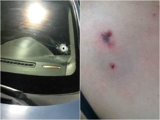 Noticias de Honduras y el mundo de hoy 25/08/17 edición matutina