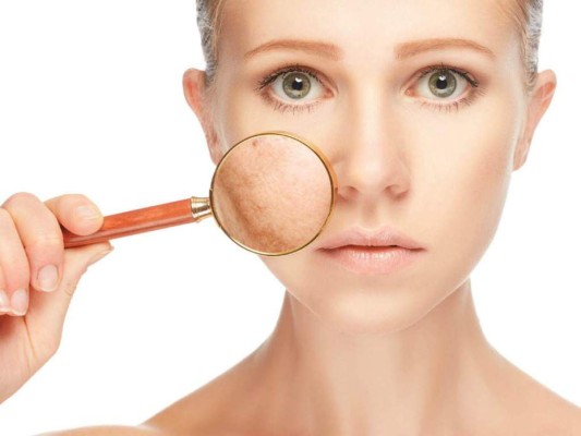 Elimina las manchas en la piel con tratamientos caseros