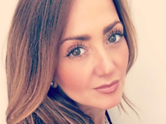 ¿Qué es la enfermedad púrpura, el padecimiento que alejó de sus labores a Andrea Legarreta?