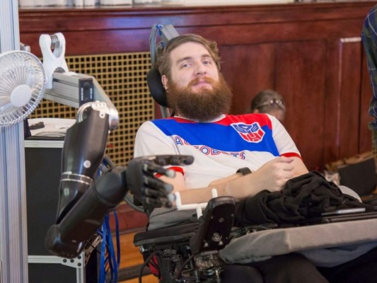 Prueban con éxito en EEUU brazo robótico controlado por la mente y con sentido del tacto