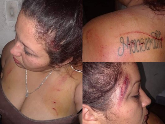 Reclusas se van a los golpes por una llamada telefónica en cárcel de mujeres de Támara&nbsp;