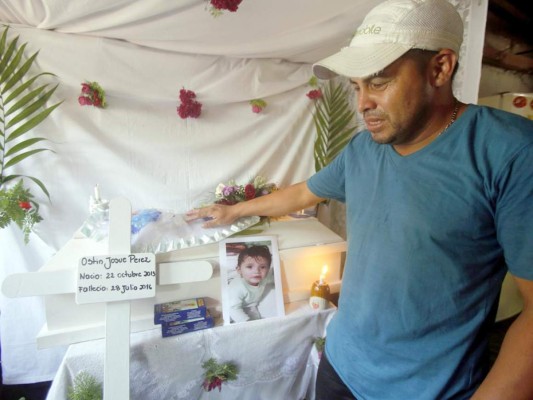 Dolido padre: Hijo lindo, ¿por qué te quemaste?