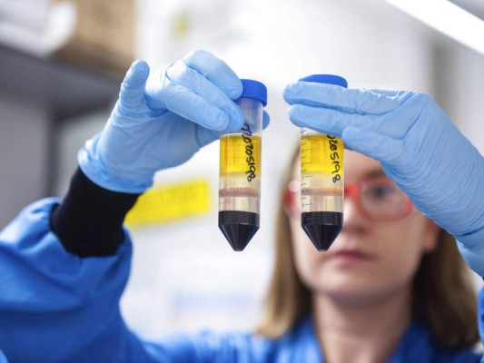 Dudas y respuestas sobre vacuna de AstraZeneca, la que recibiría Honduras