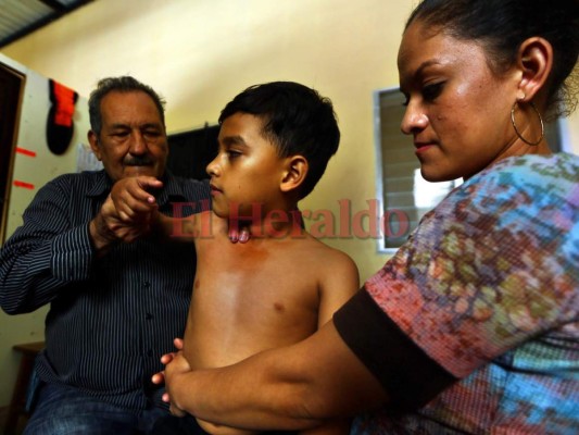 Sobador de El Lolo, don de servicio al necesitado