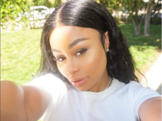 Blac Chyna asegura que recibió maltrato físico de parte de Rob Kardashian