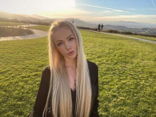 Barbie humana sorprende a todos al compartir foto antes de operarse