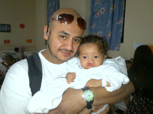 Organización hondureña apadrina 25 cirugías para niños