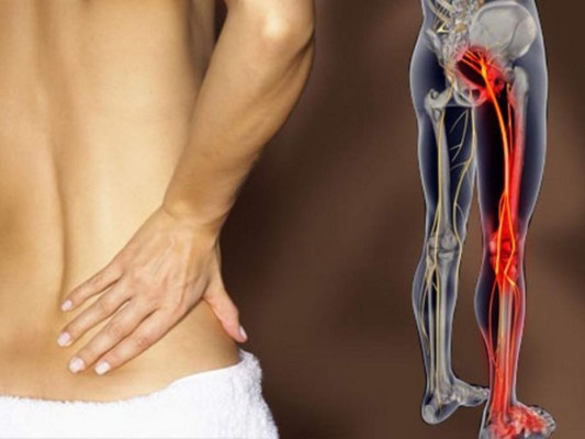 6 sencillos ejercicios que te ayudarán a aliviar el dolor del nervio ciático