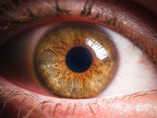 El reto visual de los tenis ¿De qué color es?