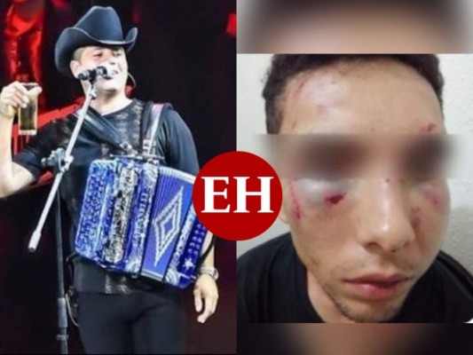 Emiten orden de captura contra Remmy Valenzuela por agresión a su primo y su novia