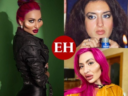 Anastasia Pokreshchuk, la mujer con los pómulos más grandes del mundo (FOTOS)