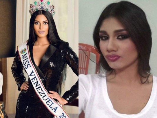 Los 'retoques' en el rostro de Sthefany Gutiérrez, Miss Venezuela, que revolucionan Internet