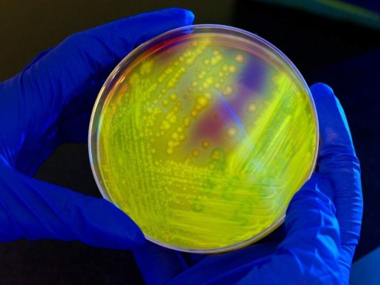 ¿Listo para viajar al extranjero de nuevo? Cuidado con las superbacterias, dice estudio