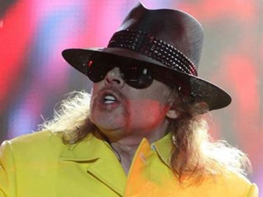 Así luce Axl Rose