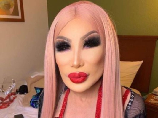 ¿Qué se hizo? Lyn May reaparece con drástico cambio de look