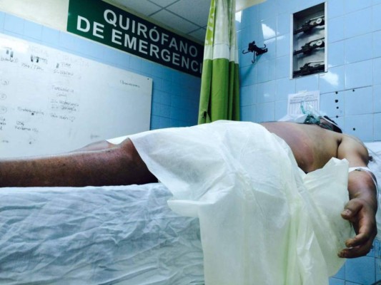 Honduras: Sobreviviente de bus que se fue a abismo relata momentos de horror que vivió