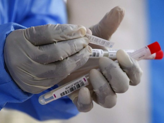 Honduras en último lugar en aplicación de pruebas para detectar coronavirus