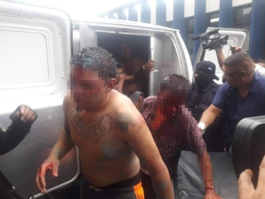 Las fuertes imágenes que dejó un enfrentamiento en la Penitenciaría Nacional de Támara