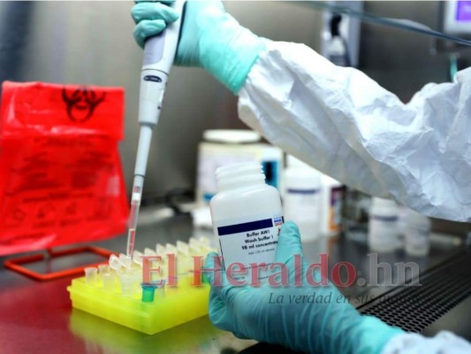 Laboratorio de Vigilancia no tiene fechas para la llegada de pruebas PCR