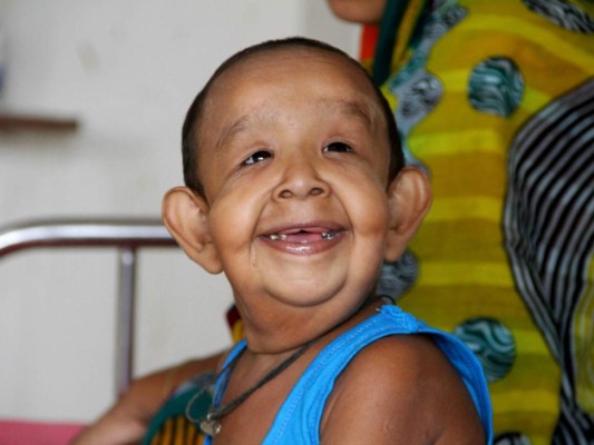 La familia ha consultado numerosos médicos pero ninguno consiguió saber de qué enfermedad se trata. Foto: AFP
