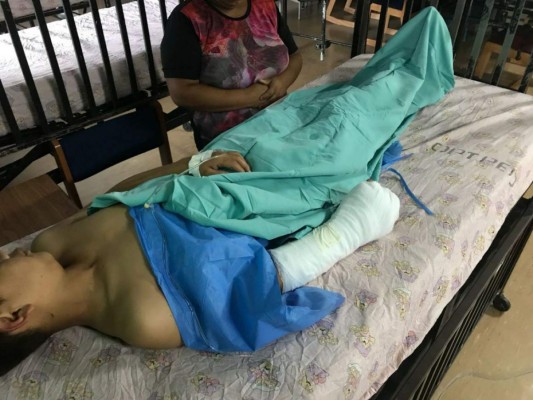 19 personas quemadas ingresaron al Hospital Escuela Universitario (HEU) por manipular pólvora en Navidad