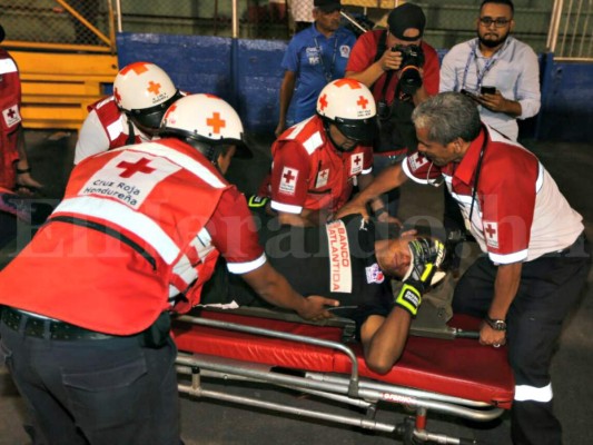 ¡ALARMA! Donis Escober se fracturó el pómulo derecho y será operado esta noche