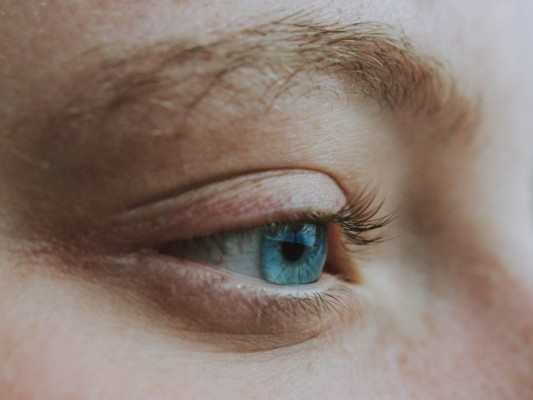 Ojos rojos o dolor intenso: Sequedad ocular ¿cómo tratar esta afección?