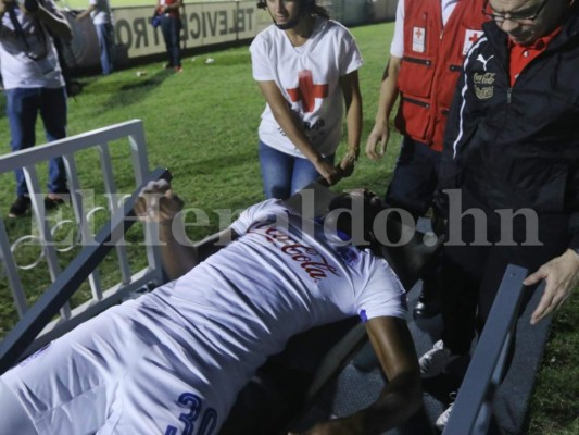 Johnny Palacios sufre roptura total del tendón de aquiles derecho y estará nueve meses