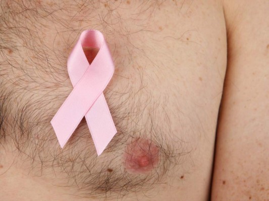 El cáncer de mama también se da en los hombre ¿Cómo identificarlo?