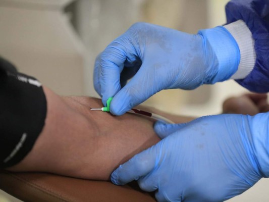 ¿En qué consiste el tratamiento del coronavirus con plasma?