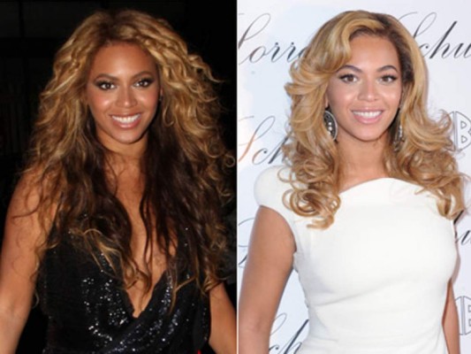 Celebridades que se han hecho drásticos cambios en el tono de piel