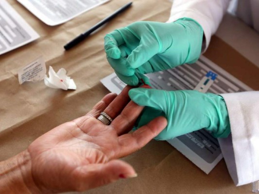 Tres personas se infectan a diario con VIH en Honduras