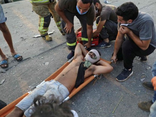 Dolorosas e impactantes imágenes de la devastadora explosión en Beirut