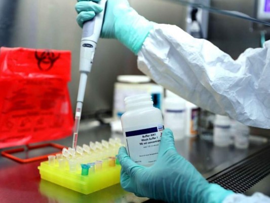 Pruebas de Covid-19 tienen mora de siete días; no se sabe hacia adonde va la curva de casos