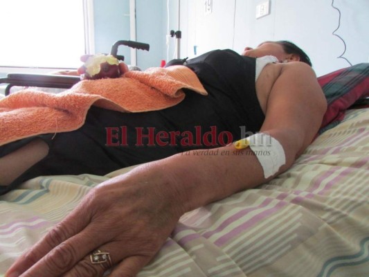 Hasta las 7:00 de la noche atenderán en los 1,606 centros de salud de Honduras por dengue